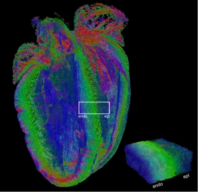 Vanderbilt University
