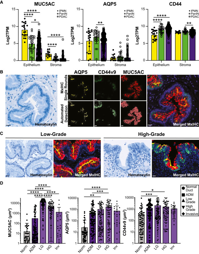 Vanderbilt University