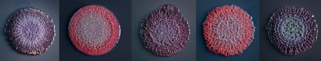 Kight E - Bacteria picture expressing curli