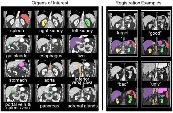 Twelve organs of interest (left) and registration examples of variable qualities for one target image (right).