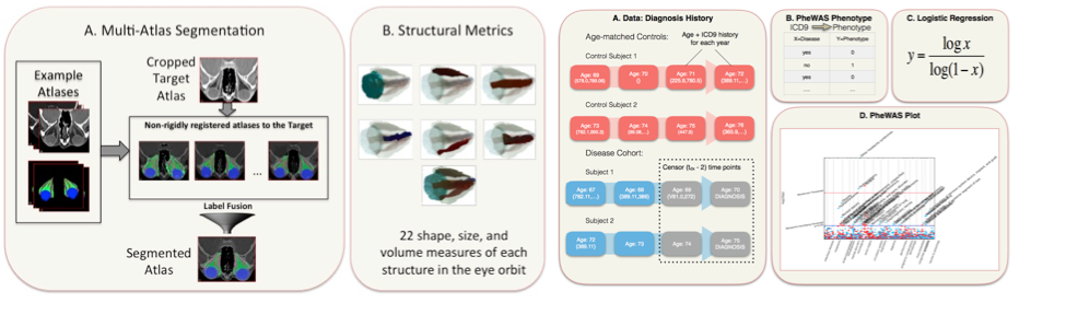 (Left) (A) In the proposed multi-atlas segmentation pipeline, atlases are non-rigidly registered to the cropped target image. Non-local statistical label fusion is used to combine the registered labels to segment a target scan. (B) Structural volume measurements are computed based on the 3-D segmentation. Illustrations of 7 orbital structures are shown. (Right) A. Shows example data for control and disease cohorts. ICD9 data is collected at each visit for each subject. ICD9 data for the disease cohort is censored from time point (tdx-2) onwards. B. ICD9s are mapped to PheWAS phenotypes and data frames are formed for each phenotype. C. Logistic regression is performed for each phenotype. D. Plot showing significant ICD9 phenotypes of glaucoma with respect to the control group. (From: Chaganti et al., “Phenotype Analysis of Early Risk Factors from Electronic Medical Records Improves Image-Derived Diagnostic Classifiers for Optic Nerve Pathology” In Proceedings of the SPIE Medical Imaging Conference. Orlando, Florida, February 2017.) 