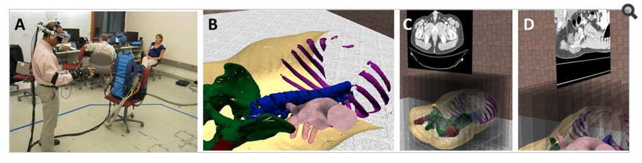 Illustrations of the proposed system in use. (a) Surgeon using the system. (b) Virtual hand interacting with 3D abdominal model. (c) Navigation of axial slices. (d) Navigation of sagittal slices.