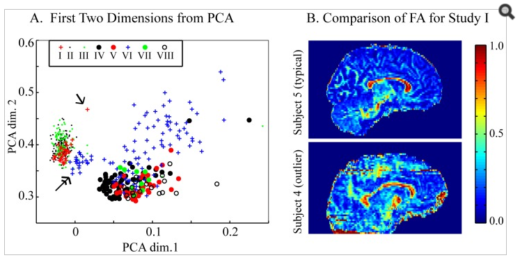 Each of the 567 DTI datasets was characterized by a 112 element vector of stored outputs from the pipeline. PCA analysis was performed on the resulting data. (A) DTI dataset locations in the first two dimensions of the PCA analysis. Data is symbolized by study Roman numeral (Table 1). Single arrow points to a data quality outlier from study I; subject 3 in Figure 4 and in (B). A double headed arrow points to a cluster representing an isolated protocol sub-group from study VI. (B) FA maps from similar sagittal slice locations in two subjects from Study I. Subject 4 is the indicated outlier in (A) and subject 5 was selected from the center of the study I cluster seen in (A).