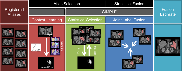 Flowchart of the proposed method. Given registered atlases with variable qualities, atlas selection and statistical fusion are considered as two necessary steps to obtain a reasonable fusion estimate of the target segmentation. The SIMPLE algorithm implicitly combines these two steps to fusion selected atlases; however, more information can be incorporated to improve the atlas segmentation, and a more advanced fusion technique can be used after the atlases are selected. We propose to (1) extract a probabilistic prior of the target segmentation by context learning to regularize the atlas selection in SIMPLE and (2) use Joint Label Fusion to obtain the final segmentation while characterizing of the correlated errors from among atlases. 