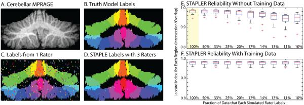 Simulations with traditional random raters. Coronal sections of the three-dimensional volume show the high resolution MRI image (A), manually drawn truth model (B), an example delineation from one random traditional rater (C), and the results of a STAPLE recombination of three label sets (D). STAPLER enables fusion of label sets when raters provide only partial datasets, but performance suffers with decreasing overlap (E). With training data (F), STAPLER improved the performance even with each rater labeling only a small portion of the dataset. Box plots in E and F show mean, quartiles, range up to 1.5σ, and outliers. The highlighted plot in E indicates the simulation for which STAPLER was equivalent to STAPLE--i.e., all raters provide a complete set of labels. 