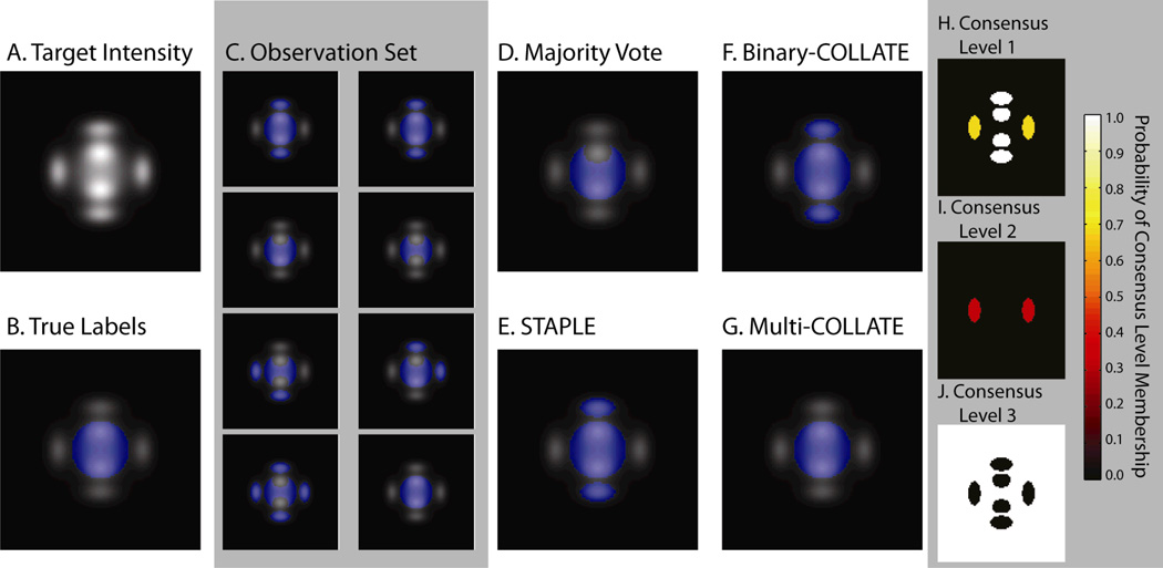 Figure 2
Results from the controlled rater observation simulation. The target intensity image and the corresponding true labels can be seen (A) and (B), respectively. The set of input observations used in this experiment can be seen in (C). The results of the four algorithms, Majority Vote, STAPLE, Binary-COLLATE and Multi-COLLATE can be seen in (D)–(G). Note that the 3 consensus-level implementation of Multi-COLLATE is the only algorithm that gets the correct answer. The 3 energy in each of the consensus levels can be seen in (H)–(J). Note that by distributing the non-consensus voxels into two separate levels, (H) and (I), the estimation process converges to the correct answer.