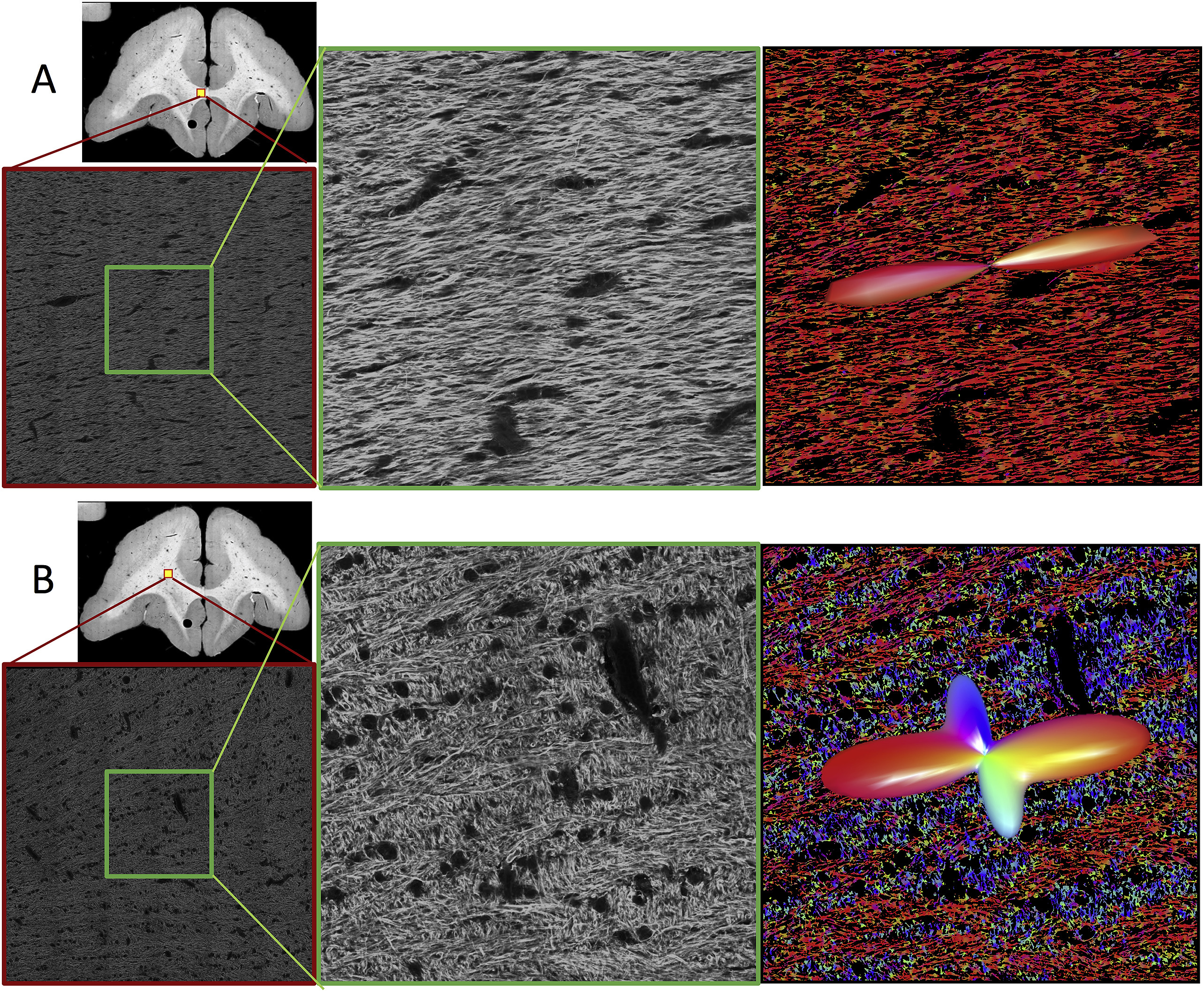 Qualitative confocal images. Representative confocal data (of a single slice) are shown for single (A) and crossing (B) fiber regions. Overview images highlight location of full 3D z-stacks (shown as a single, middle slice). A zoomed regions of interest in the middle of the z-stack (equivalent in size to an MRI voxel) are shown in the middle column. Results from structure tensor analysis are shown as color-coded images (with colors scheme as described in Fig. 1), with the histologically-defined FOD overlaid as 3D glyphs (right).