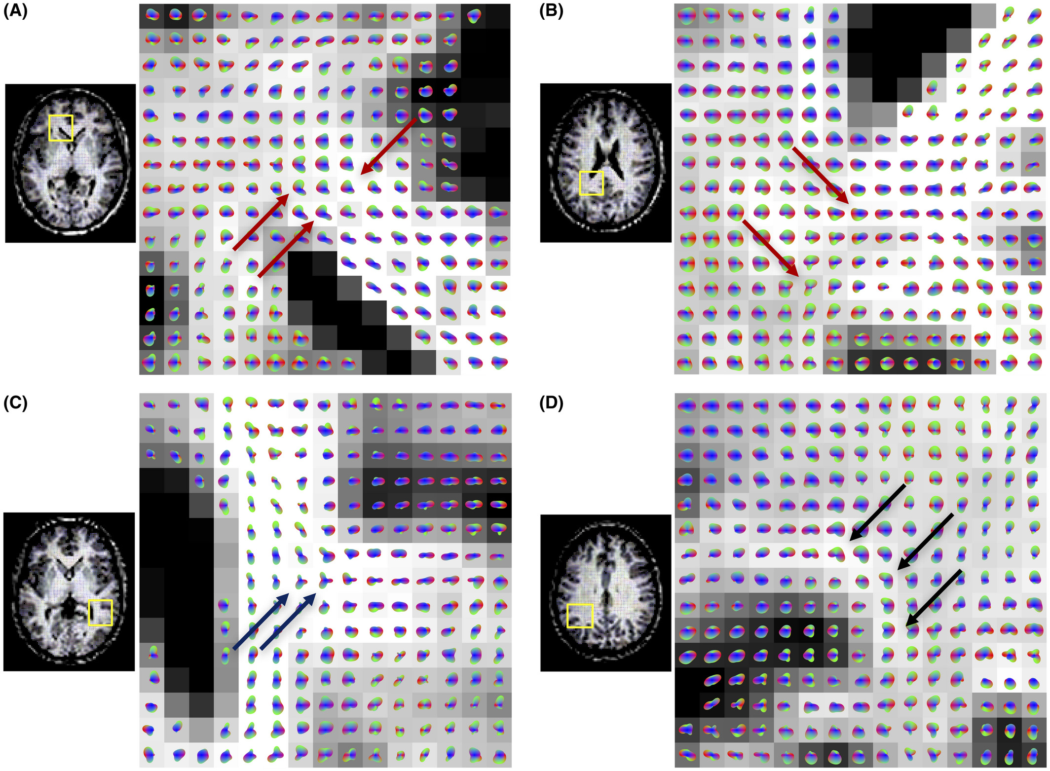 HARFI is able to capture complex, asymmetric functional distributions. Fiber fanning (A, B; red arrows), three‐way crossings (C; blue arrows), and bending (D; black arrows) voxels are reconstructed in regions expected to contain complex distributions