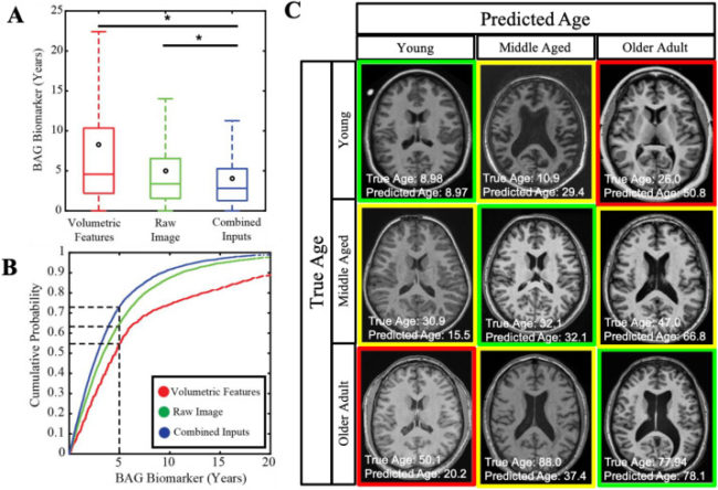 Anatomical Context Improves Deep Learning On The Brain Age Estimation Task Medical Image