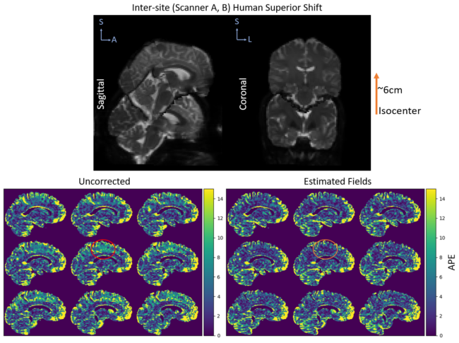 Figure 6.  The absolute percent error (APE) in MD is shown for the human subject with one session acquired at isocenter on scanner A and another acquired 6cm superior from isocenter on scanner B. The top plot shows the sagittal and coronal view of the b0 from each session to demonstrate the shift within the scanner. The bottom plots show the APE for nine saggital slices before correction, after correction using the estimated fields, and after correction using the manufacturer specifications. The error before correction is most prominent in the superior regions of the phantom as those were the furthest from isocenter during the second acquisition.