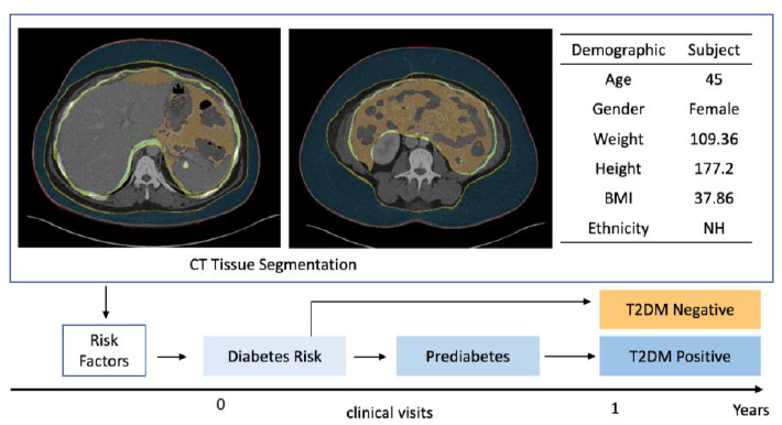 diabetes onset prediction