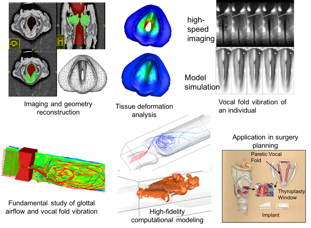 Research on vocal fold vibration