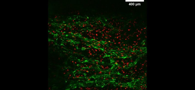 Co-culture of endothelial cells (green) lining a channel network formed with sacrificial microfibers and fibroblasts (red) embedded in gelatin
