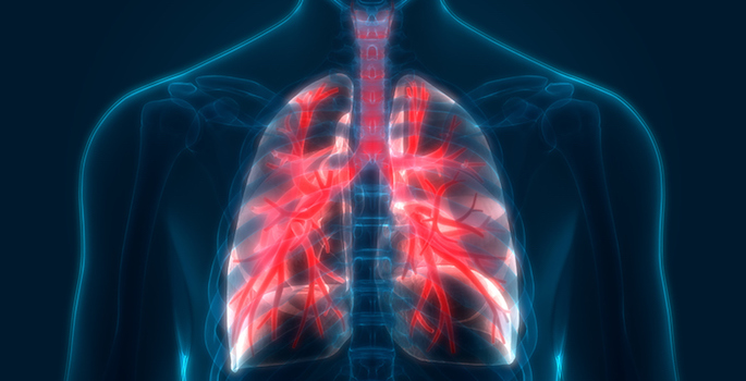 Vanderbilt research played key role in new lung screen guidelines