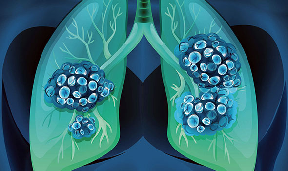 Study reveals need for matching targeted therapies with EGFR subtypes