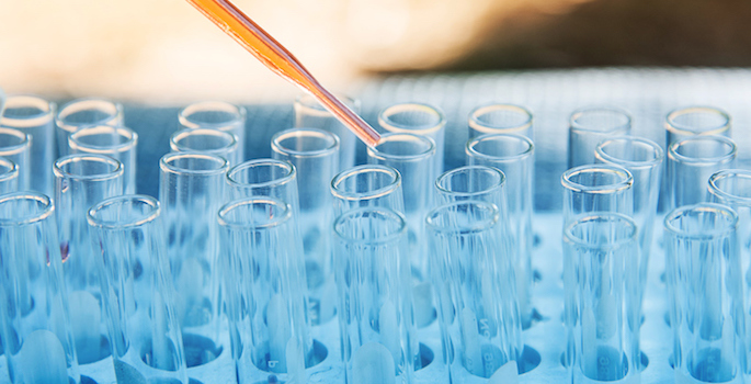 array of test tubes with pipette dropping fluid into one