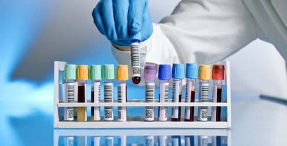 gloved hand placing test tube on rack full of other test tubes