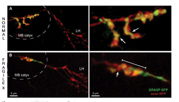 four versions of neuron under microscope