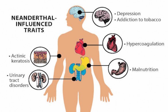 infographic showing body parts affected by neanderthal genes