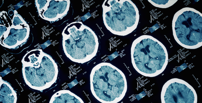 Vanderbilt researchers make extensive brain imaging data set available for cross-disciplinary study