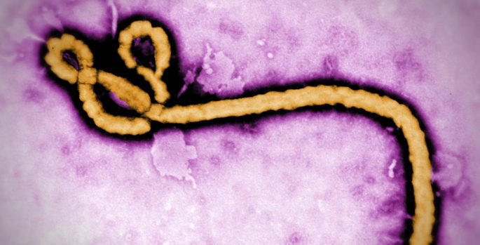 ebola under microscope