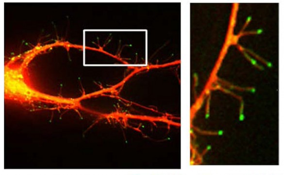 cells with long threads extending from edges