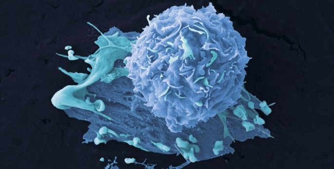 ‘Multi-omics’ reveals treatment option for breast cancer subtype