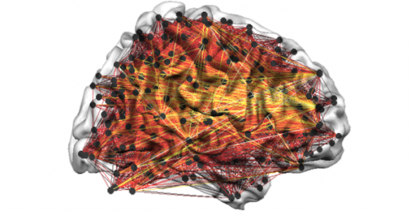 Illustration of brain showing connection that appear during awareness.