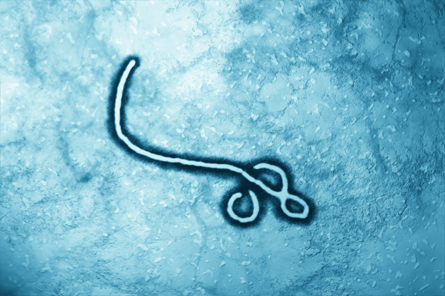Ebola virus under microscope.