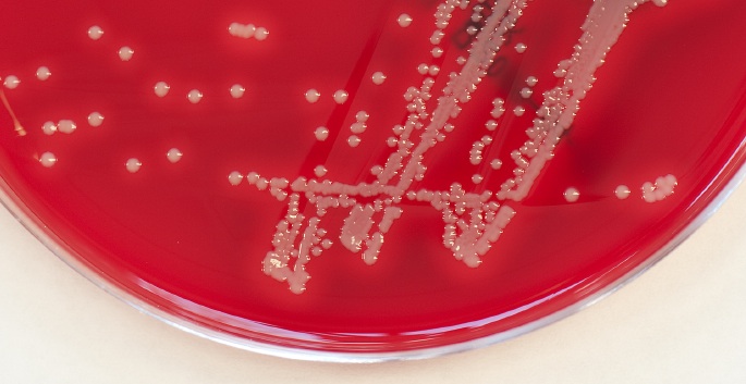 staph colonies on red petri dish