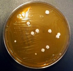 bacteria