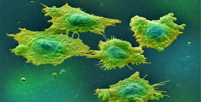 Research Snapshot: Discovery points to new avenues to kill aggressive cancer cells