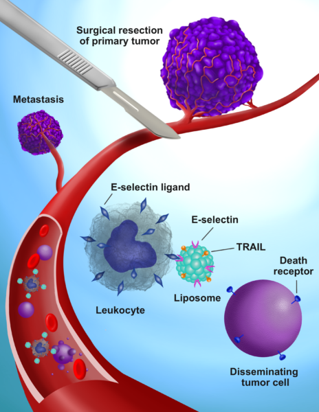 Cellular Soldiers Designed To Kill Cancer Cells That Get Loose During