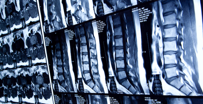 x-rays of spinal column
