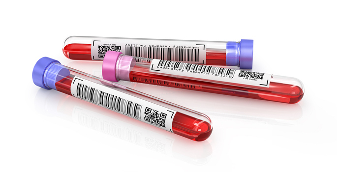 three blood test vials on a white background