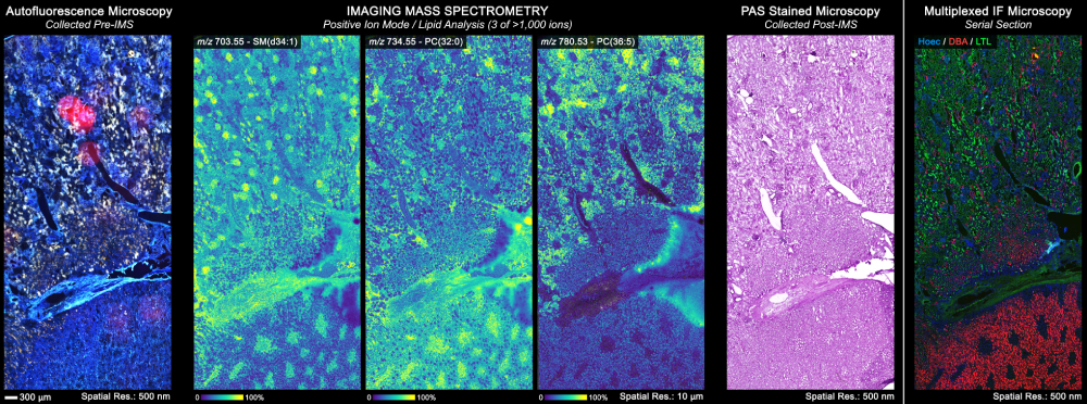 Imaging mass spectrometry data