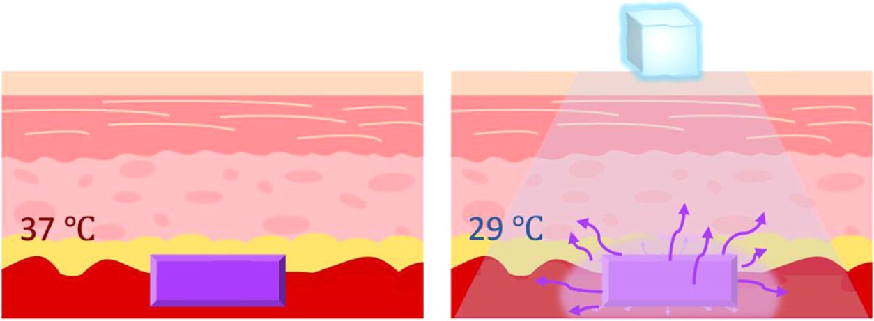 Vanderbilt University
