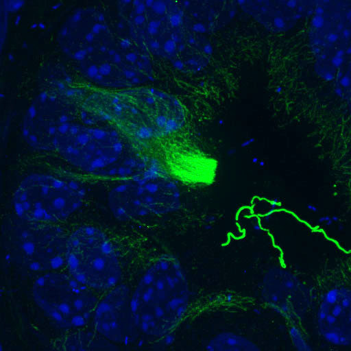 We use a number of different imaging strategies to study these populations, including immunofluorescence (Green, ac-a-tubulin; Blue, nuclei).