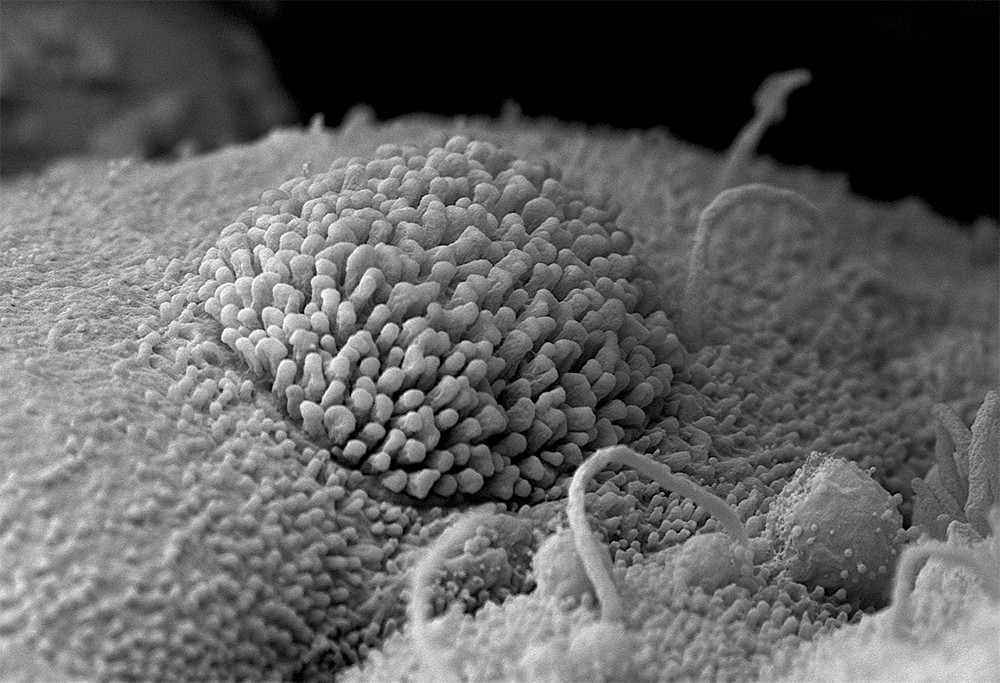 Scanning electron microscopy allows us to investigate the cell surface. Tuft cells are known for their long, blunt microvilli and structure often provides clues to function.