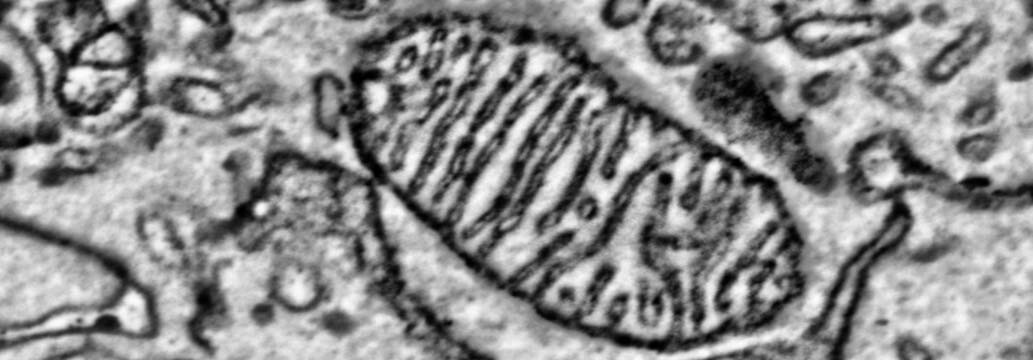 Mitochondria with Cristae, BSE Image