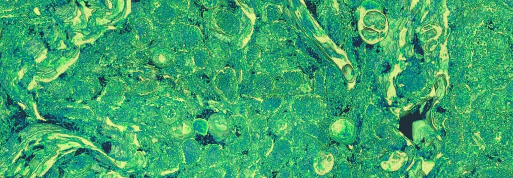 FIB-SEM Volume of Mouse Kidney Tissue