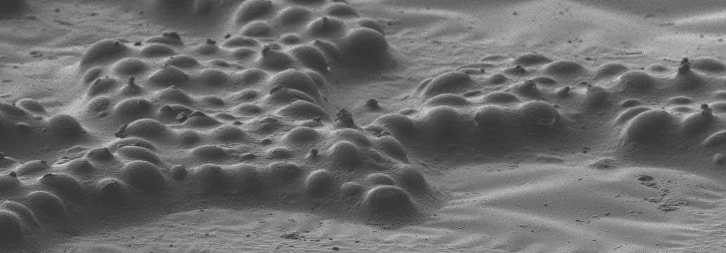 Vitrified Yeast on Carbon Support – Cryo-SEM
