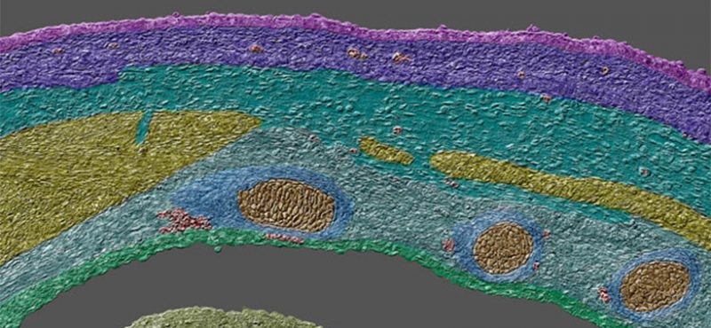 embryonic body wall, image courtesy Burnett Lab