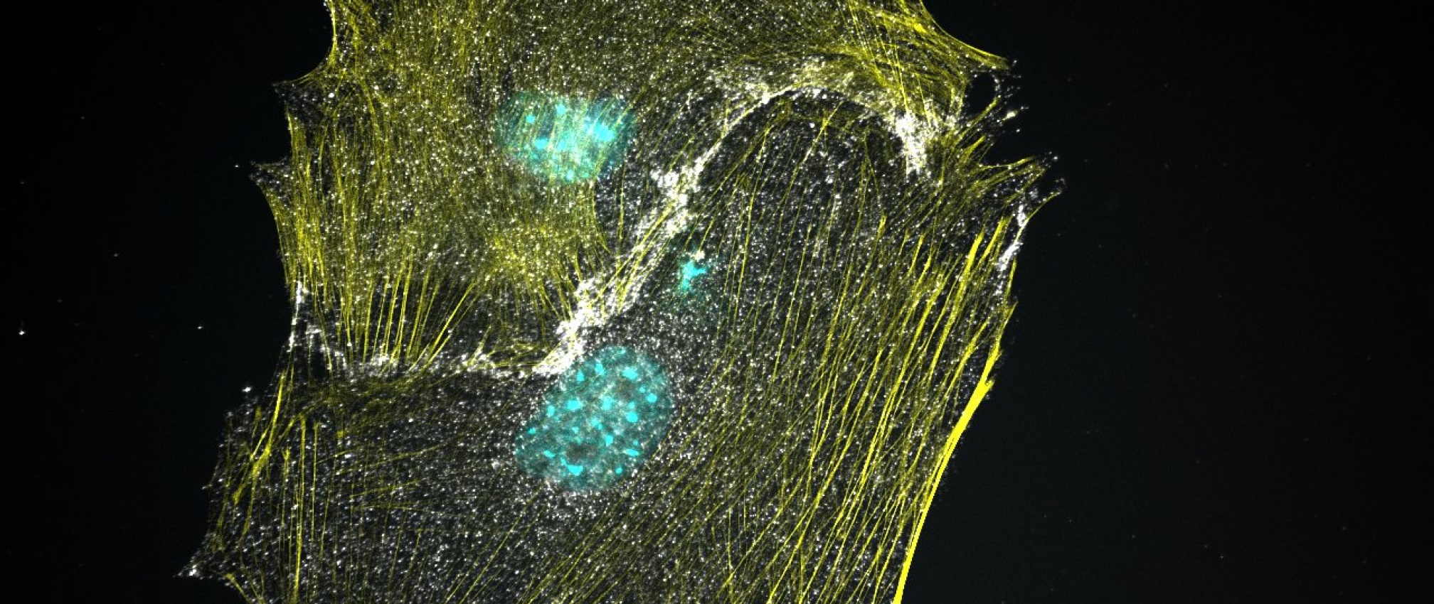 Casein Kinase 1alpha null MEF cells exhibit constitutively active Wnt signaling. Cytosolic beta-catenin (white) localization has now been shifted to the nucleus (blue). Beta-catenin also remains localized at cell-cell contact as part of the cadherin complex. Actin is labeled in yellow.