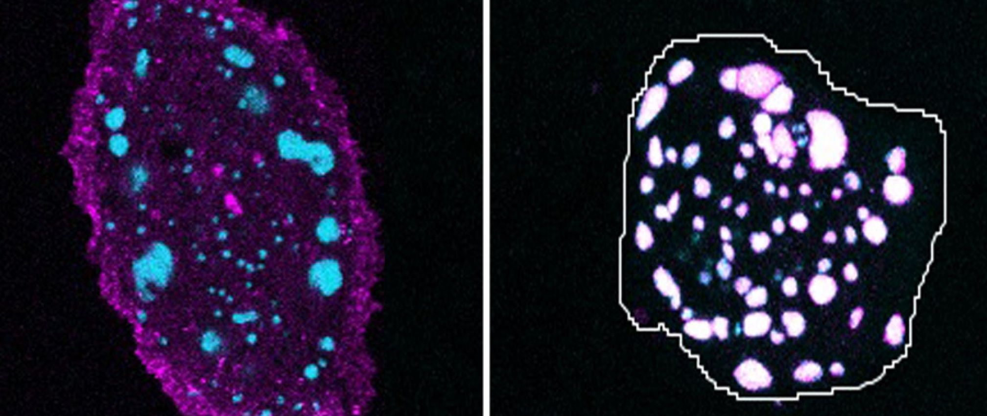 LRP6 (magenta) is internalized and colocalizes with Axin (cyan) upon Wnt ligand activation.  Left panel shows untreated RPE cells.  Right panel  shows RPE cells treated with Wnt3a.