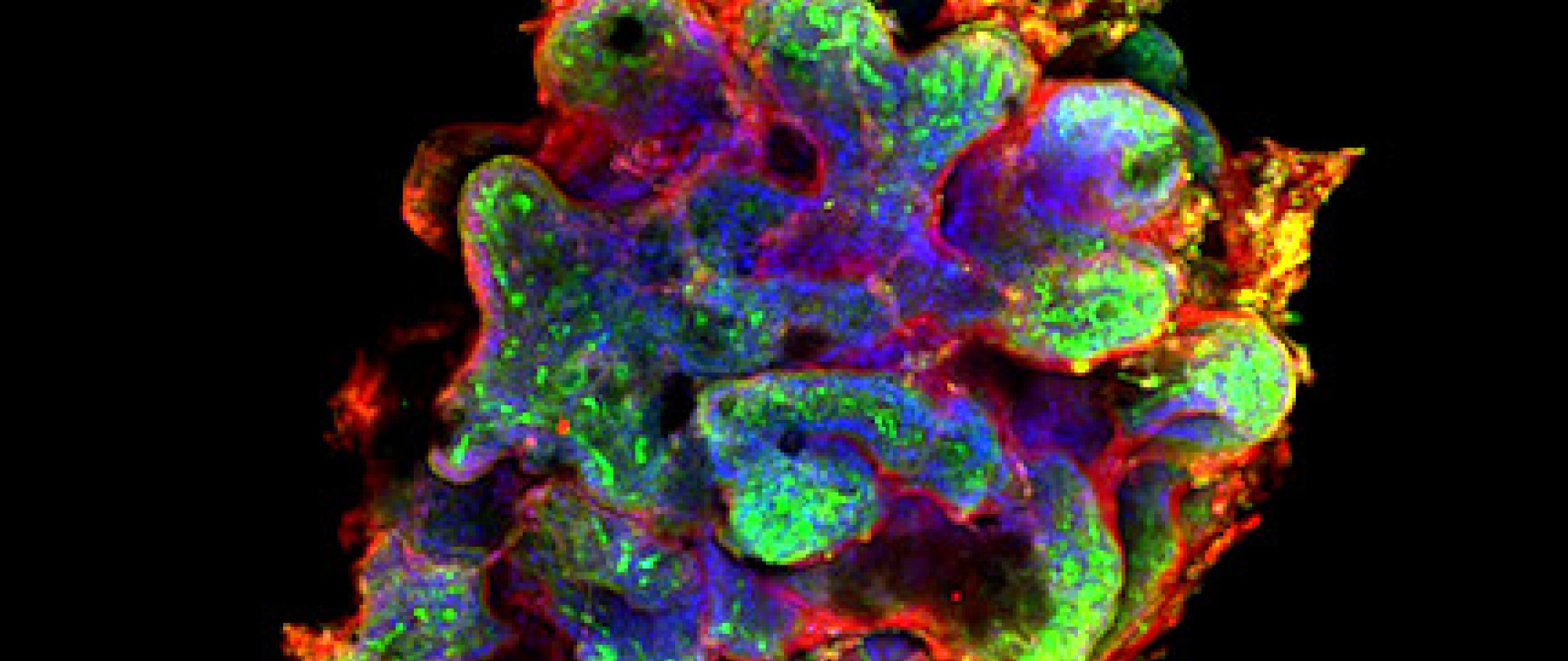 Human intestinal organoids generated from IPS cells.  Beta-catenin  is (red), actin (green) and DNA (blue).