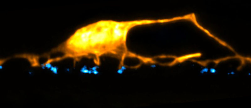Dendritic spines (yellow) appose presynaptic vesicles (blue)