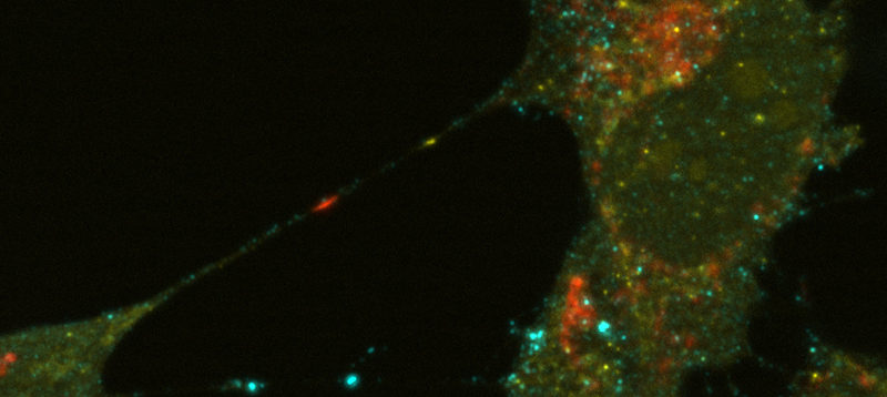 mutant KRAS colorectal cancer cells exchange extracellular miR-100 (yellow) and miR-associated protein Aego2 (cyan). LAMP1, another protein found to be secreted by cancer cells in exosomes are marked in red