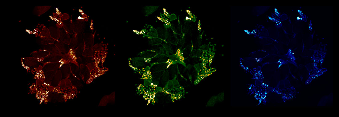 Drosophila ovaries stained with DAPI.