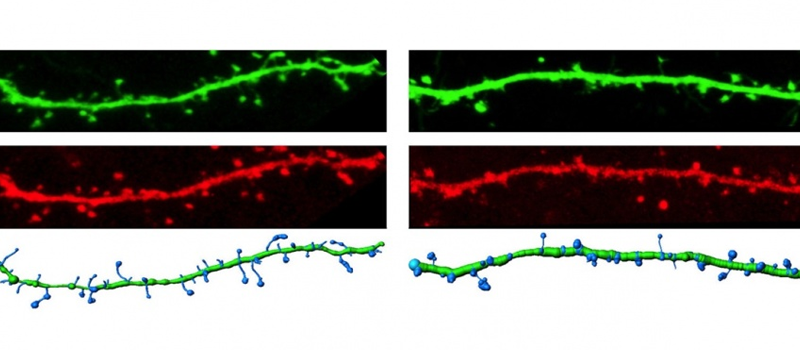 Filled dendrites (green) from neurons expressing wild type CaMKII or the ASD-linked E183V mutant (red; left, right, respectively), with a computerized reconstruction highlighting the dendritic spines (Jay Stephenson, Postdoc, Colbran Lab)